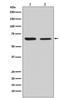 Dihydropyrimidinase Like 2 antibody, M02860, Boster Biological Technology, Western Blot image 