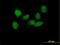 SRY-Box 6 antibody, H00055553-B01P, Novus Biologicals, Immunofluorescence image 