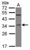 Methyltransferase Like 6 antibody, NBP2-17280, Novus Biologicals, Western Blot image 