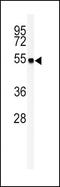 Glutamic-Oxaloacetic Transaminase 1 antibody, PA5-24634, Invitrogen Antibodies, Western Blot image 