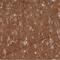 Rho GDP Dissociation Inhibitor Alpha antibody, NBP2-14041, Novus Biologicals, Immunohistochemistry paraffin image 