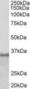 ATP Binding Cassette Subfamily D Member 2 antibody, 43-053, ProSci, Western Blot image 