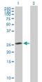 HAUS Augmin Like Complex Subunit 2 antibody, H00055142-B01P, Novus Biologicals, Western Blot image 