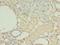Heterogeneous Nuclear Ribonucleoprotein L antibody, LS-C369788, Lifespan Biosciences, Immunohistochemistry paraffin image 