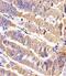 Receptor Tyrosine Kinase Like Orphan Receptor 2 antibody, A01840-1, Boster Biological Technology, Immunohistochemistry paraffin image 