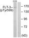 Fms Related Tyrosine Kinase 3 antibody, PA5-38273, Invitrogen Antibodies, Western Blot image 