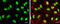 DNA Topoisomerase II Beta antibody, GTX102640, GeneTex, Immunofluorescence image 