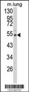 EGF Containing Fibulin Extracellular Matrix Protein 1 antibody, MBS9202010, MyBioSource, Western Blot image 