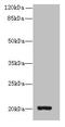 Zinc Finger And BTB Domain Containing 8 Opposite Strand antibody, CSB-PA816894LA01HU, Cusabio, Western Blot image 