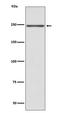 Myosin Heavy Chain 6 antibody, M02808, Boster Biological Technology, Western Blot image 