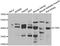 Cystinosin, Lysosomal Cystine Transporter antibody, A01452, Boster Biological Technology, Western Blot image 