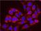 G3BP Stress Granule Assembly Factor 1 antibody, NBP1-18922, Novus Biologicals, Proximity Ligation Assay image 