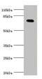 Potassium Voltage-Gated Channel Subfamily D Member 2 antibody, LS-C675932, Lifespan Biosciences, Western Blot image 