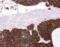 Keratin 5 antibody, BSH-7123-1, Petra Hansson, Immunohistochemistry frozen image 