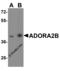 Adenosine A2b Receptor antibody, 8111, ProSci Inc, Western Blot image 