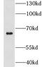 G Protein-Coupled Receptor Kinase 1 antibody, FNab03652, FineTest, Western Blot image 