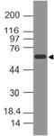 Thrombomodulin antibody, A01325, Boster Biological Technology, Western Blot image 