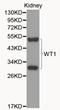 WT1 Transcription Factor antibody, LS-C192459, Lifespan Biosciences, Western Blot image 