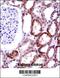 CD70 Molecule antibody, 57-954, ProSci, Immunohistochemistry frozen image 