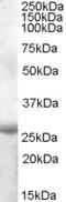 ATP Binding Cassette Subfamily A Member 9 antibody, 46-792, ProSci, Western Blot image 