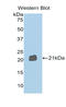 Semaphorin-4B antibody, LS-C296378, Lifespan Biosciences, Western Blot image 