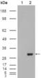 Carbonic Anhydrase 1 antibody, abx010481, Abbexa, Enzyme Linked Immunosorbent Assay image 