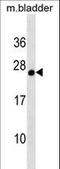 Glutathione S-Transferase Alpha 3 antibody, LS-C158201, Lifespan Biosciences, Western Blot image 