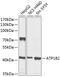 ATPase Na+/K+ Transporting Subunit Beta 2 antibody, 23-978, ProSci, Western Blot image 