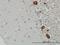Phenylalanyl-TRNA Synthetase Subunit Beta antibody, H00010056-M01, Novus Biologicals, Immunohistochemistry paraffin image 