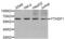 YTH N6-Methyladenosine RNA Binding Protein 1 antibody, abx004595, Abbexa, Western Blot image 