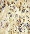 Eukaryotic Translation Initiation Factor 4E Family Member 2 antibody, LS-C167704, Lifespan Biosciences, Immunohistochemistry frozen image 