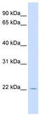 RHEB Like 1 antibody, TA340330, Origene, Western Blot image 