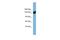 Aminoadipate-Semialdehyde Dehydrogenase antibody, A11060, Boster Biological Technology, Western Blot image 