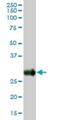 Bone Marrow Stromal Cell Antigen 2 antibody, H00000684-B02P, Novus Biologicals, Western Blot image 