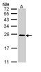 RAS Related 2 antibody, LS-C186165, Lifespan Biosciences, Western Blot image 