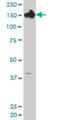 Carbamoyl-Phosphate Synthase 1 antibody, H00001373-M02, Novus Biologicals, Western Blot image 