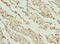 Glycerate Kinase antibody, LS-C675815, Lifespan Biosciences, Immunohistochemistry paraffin image 