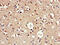 AP2 Associated Kinase 1 antibody, CSB-PA643571LA01HU, Cusabio, Immunohistochemistry frozen image 