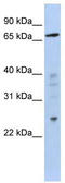 Zinc Finger Protein 510 antibody, TA343761, Origene, Western Blot image 