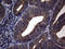 Phosphatidylinositol Transfer Protein Beta antibody, LS-C794866, Lifespan Biosciences, Immunohistochemistry paraffin image 