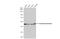 Fumarate Hydratase antibody, GTX109877, GeneTex, Western Blot image 