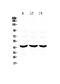 Adenosine Deaminase antibody, PA5-78721, Invitrogen Antibodies, Western Blot image 