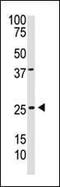 Platelet Derived Growth Factor Subunit B antibody, PA5-11723, Invitrogen Antibodies, Western Blot image 