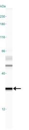 O-6-Methylguanine-DNA Methyltransferase antibody, NB100-168, Novus Biologicals, Western Blot image 