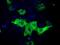 Insulin Like Growth Factor 2 MRNA Binding Protein 2 antibody, GTX84306, GeneTex, Immunofluorescence image 