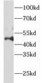 Forkhead Box O4 antibody, FNab03203, FineTest, Western Blot image 