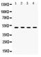 Sulfotransferase Family 2B Member 1 antibody, PB9822, Boster Biological Technology, Western Blot image 