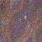 Intercellular Adhesion Molecule 1 antibody, GTX76497, GeneTex, Immunohistochemistry frozen image 