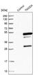 Tropomodulin 4 antibody, PA5-55795, Invitrogen Antibodies, Western Blot image 