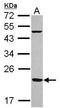 Ferritin Mitochondrial antibody, GTX117281, GeneTex, Western Blot image 